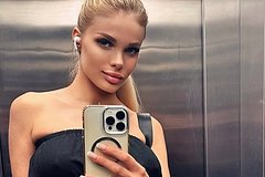 Избитая бойфрендом российская инста-модель забыла о сыне после трепанации черепа